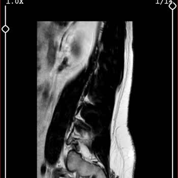 MACFit (İstanbul Avrupa) Kale Center Şubesinden Aldığım Üyelik Hakkında Şikayetim