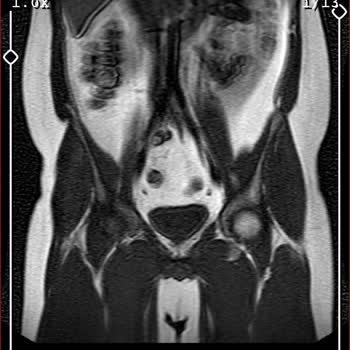 MACFit (İstanbul Avrupa) Kale Center Şubesinden Aldığım Üyelik Hakkında Şikayetim