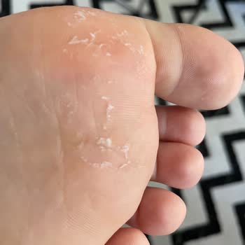 Sneaks Up Yaşanan Sorunla İlgili Dönüş Yapmıyor, İlgisiz Davranıyor.