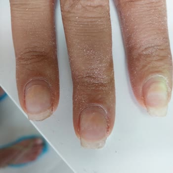 Gold Nail Center (Ankara) Protez Tırnak Mantar