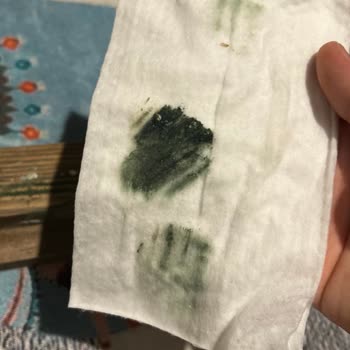 Koçtaş'tan Aldığım Küflenmiş Karyola