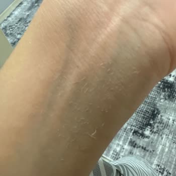 Loreal Primer Silgi Gibi Ufalanıyor