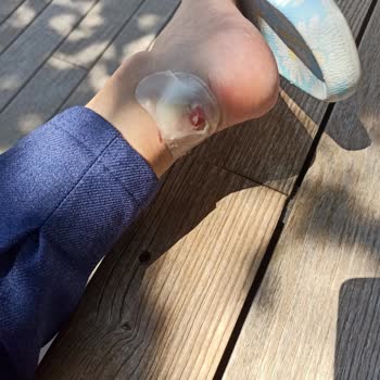 Converse Ayak Parçalayan Ayakkabı