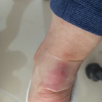 Converse Ayak Parçalayan Ayakkabı