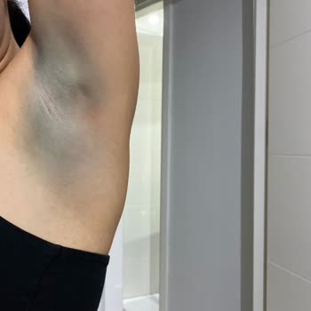Zara Kusurlu Ürün Gönderimi