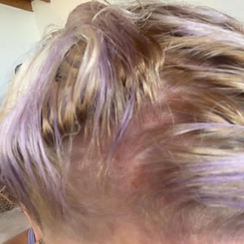 Palette Saç Boyası Saçımı Yaktı Ve Saçımın Rengini Bozdu