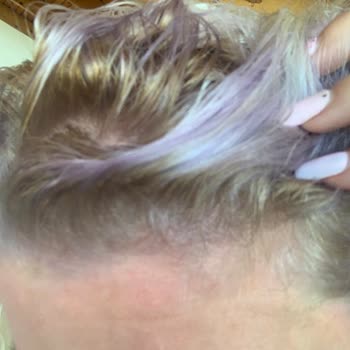 Palette Saç Boyası Saçımı Yaktı Ve Saçımın Rengini Bozdu