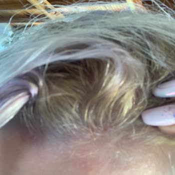 Palette Saç Boyası Saçımı Yaktı Ve Saçımın Rengini Bozdu