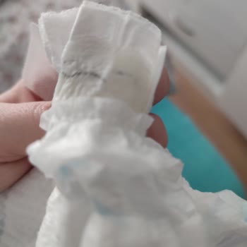 Molfix Yeni Serisi Aşırı Kötü