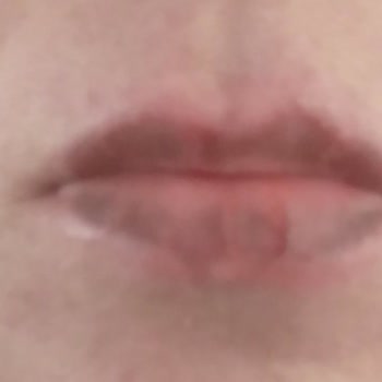 Kozan Devlet Hastanesi Eksiklik Var İncelenmemesi