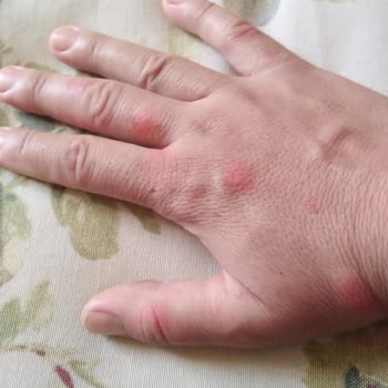 Kozan Devlet Hastanesi Eksiklik Var İncelenmemesi