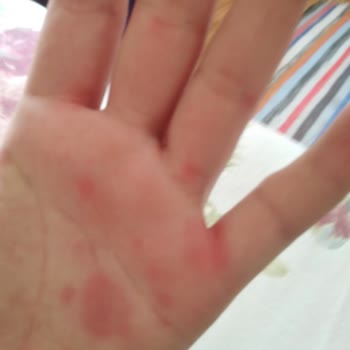 Kozan Devlet Hastanesi Eksiklik Var İncelenmemesi