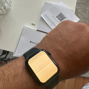 Apple Watch Saatimi Sağlam Aldı Kırık Şekilde Gönderdi!