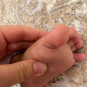 Merinos'un Halısından Nefret Geldi Ya