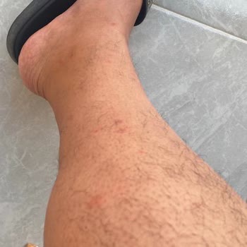 Loxia Comfort Club Side Tam Bir Hayal Kırıklığı Oldu!