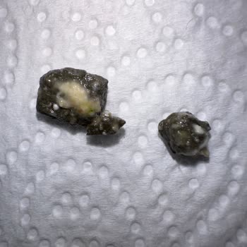 Helvacım Gıda Helvadan Taş Çıktı