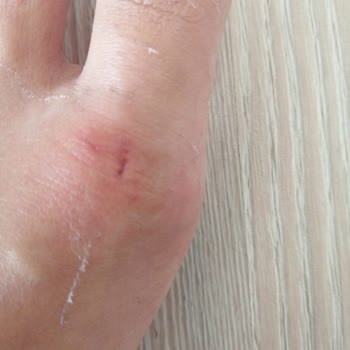 Airbnb''de Mağduriyetin Haksız Tazminatla Taçlandırılması