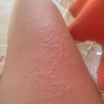 Seferihisar Belediyesinin Dereyi Temizleyip İlaçlaması