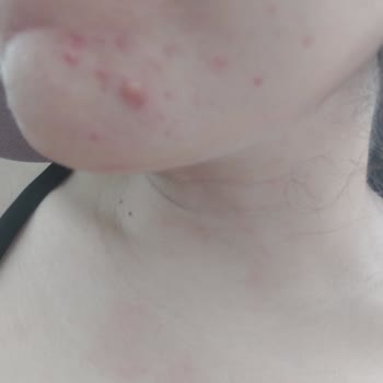 Luxun Natural Cosmetics Altınlı Serum - Büyük Hayal Kırıklığı!