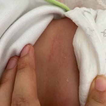 Sleepy Emici Taneciklerin Dışarı Çıkması