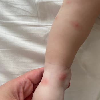 Detan Marka Sinek Kovucu