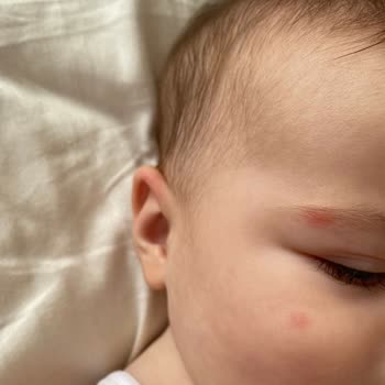 Detan Marka Sinek Kovucu