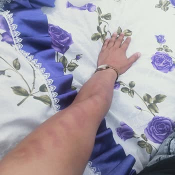 Sarat Beauty Lazer Epilasyon Sıkıntısı