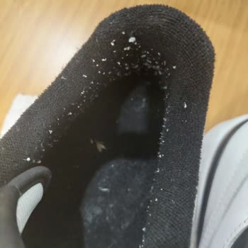 Adidas Kusurlarını Kabul Etmiyorlar Yaz Boyu Mağdur Ettiler