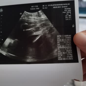 Ankara Pursaklar Duru Tıp Merkezi'nde Verilen Yanlış Bilgi Ve Hizmet