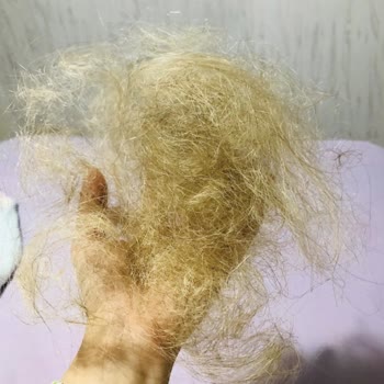 Berk Kurtuluş Hair Studio Saçlarım Yandı Ve Koptu