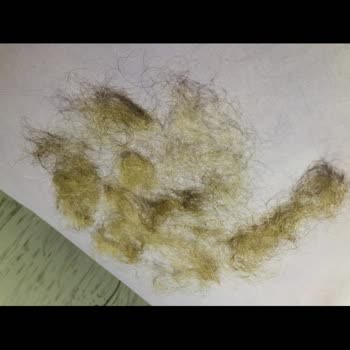 Berk Kurtuluş Hair Studio Saçlarım Yandı Ve Koptu