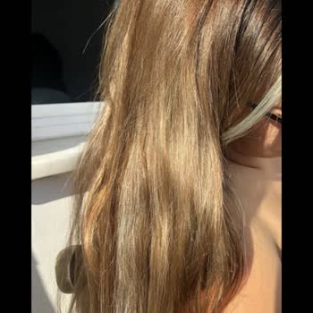 Berk Kurtuluş Hair Studio Saçlarım Yandı Ve Koptu