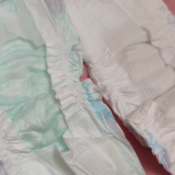 Molfix Değişen Bebek Bezi