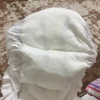 Molfix Bebek Bezi Şikayet