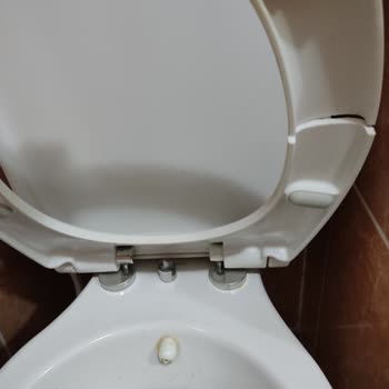 Vitra Klozet Kapağı Çürüklüğü