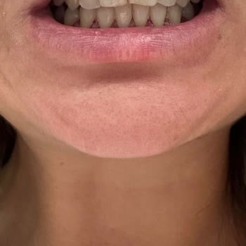 Dr. Hüseyin Öner Ortodonti Tedavi Memnuniyetsizlik