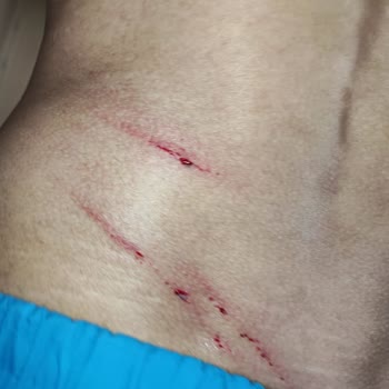 Hotel Blue Star İlgisiz Yönetim Bozuk Yabancı Oteli