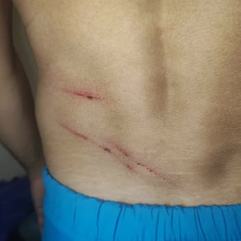 Hotel Blue Star İlgisiz Yönetim Bozuk Yabancı Oteli