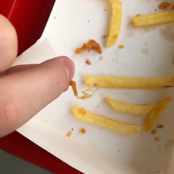 KFC Yemeğin İçinden Tüy Çıkması