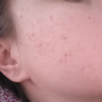 Yves Rocher Elixir Botanique Güneş Kremi Yüzüm Bakılmayacak Halde