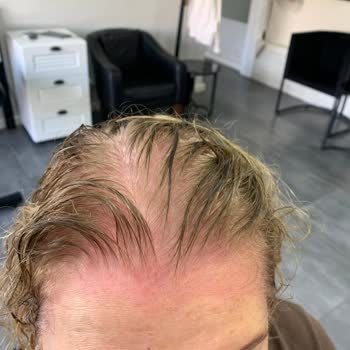 Lila Kozmetik Saç Boyası Yakıyor