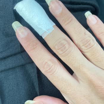 Gratis Tırnak İşlemi Esnasında Kesilen Deri