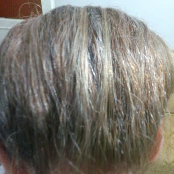 Garnier Boya Aldım Saçlarım Sarı Olması Gerekirken Rengarenk Oldu