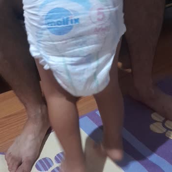 Molfix Bez Son Aldığım Ürün Problemli