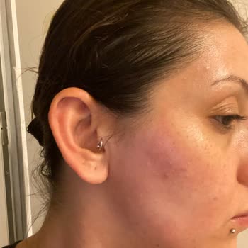 Claderm Kolajen Kil Maskesi