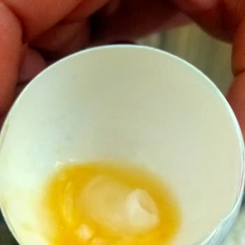 Ercanlar Yumurta Yumurtanın İçinde Bulduğum Şey