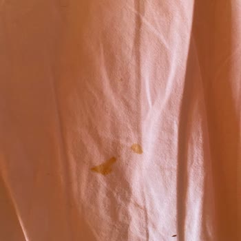 Ck Sapanca Temizlik Ve Hijyen Sorunu