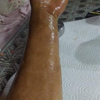 Karaca Züccaciye Karaca Red Düdüklü Tencere Seti Patladı