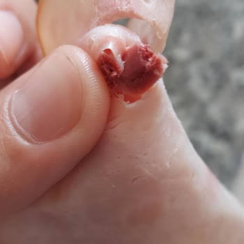 Aytaç Gıda Hindi Fümede Kıkırdak Çıktı