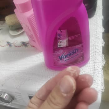 Vanish Kosla Elimde Yanma Kızarıklık